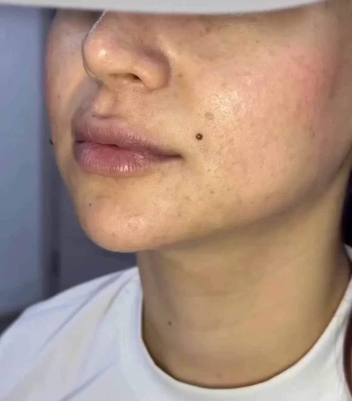 Avant soin skin booster — texture de peau